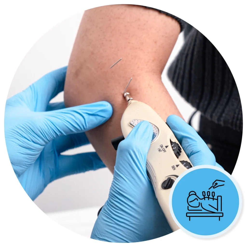 what is dry needling